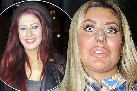 chloe ferry before and after.